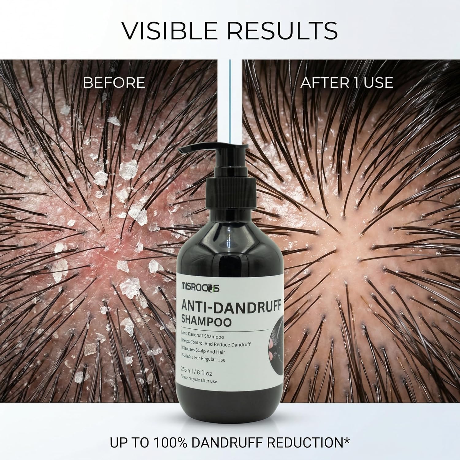 Hair Care Essentials – Anti-Dandruff Shampoo